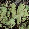 kidney-lichen-nephroma-